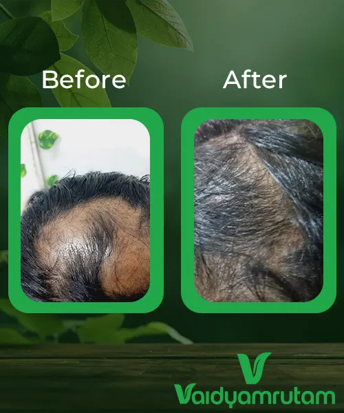 Before After Result 1