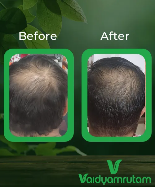 Before After Result 1