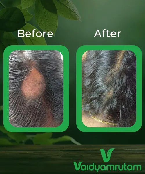 Before After Result 1