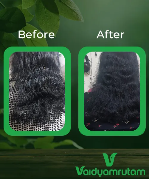 Before After Result 1