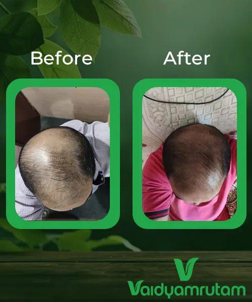 Before After Result 1