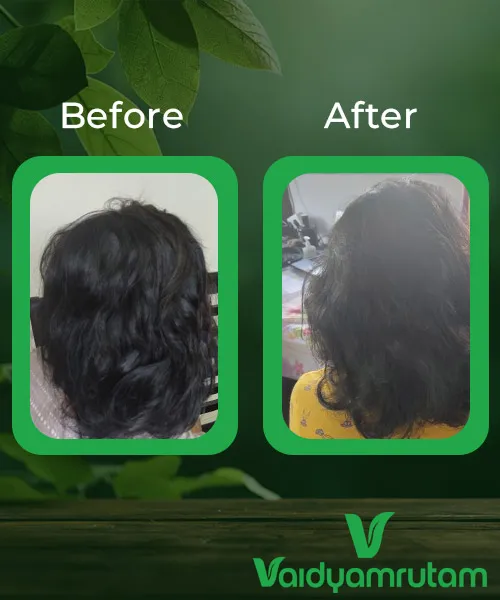 Before After Result 1