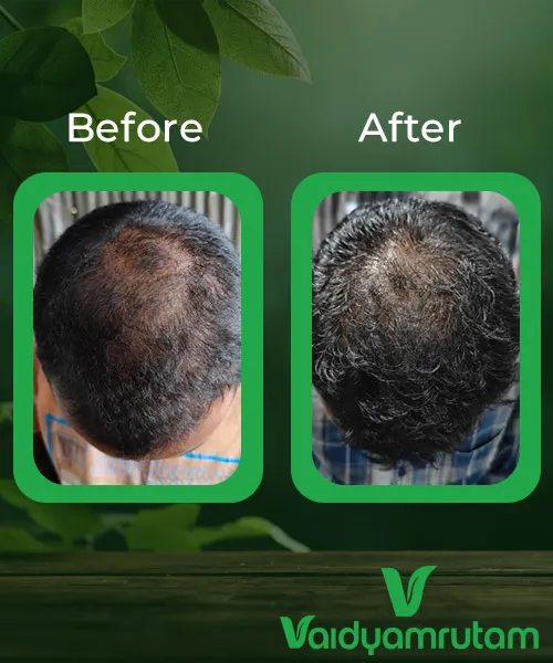 Before After Result 1