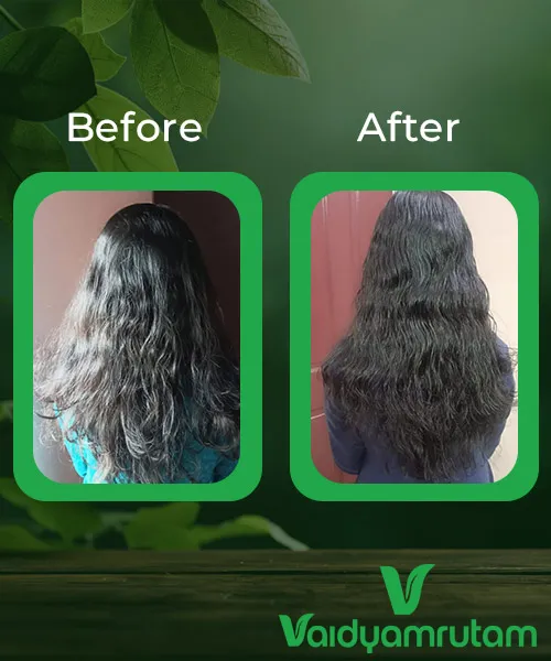 Before After Result 1