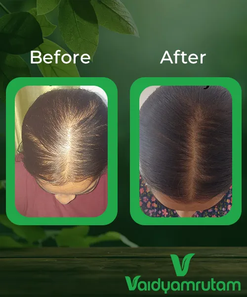 Before After Result 1